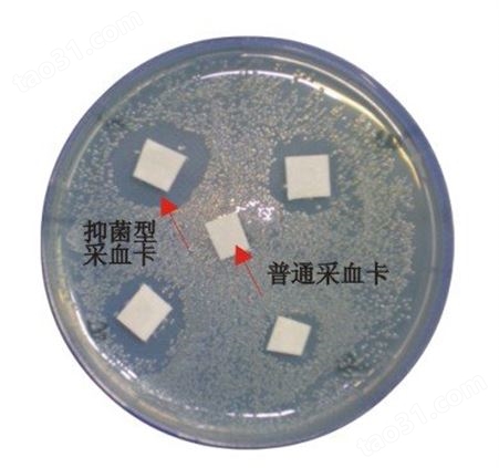 北京华兴瑞安 DNA采集卡 抑菌型血样采集卡（国产基材）