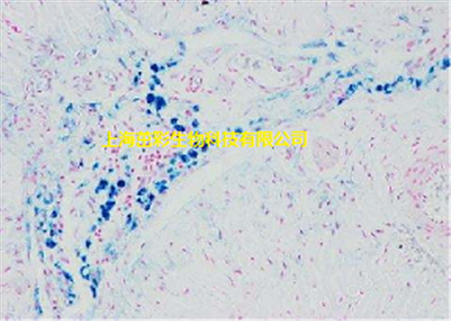肥大细胞染色 上海茁彩检测服务
